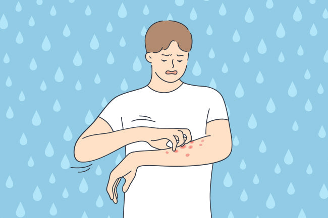 Aquagenic Urticaria: The Rare 'Water Allergy' Causing Hives After ...