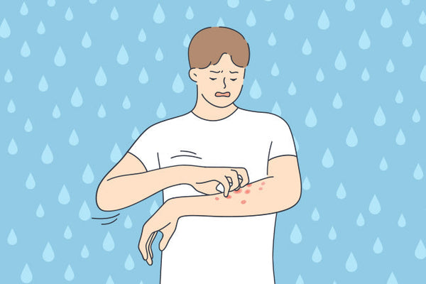 Aquagenic Urticaria: The Rare 'Water Allergy' Causing Hives After ...